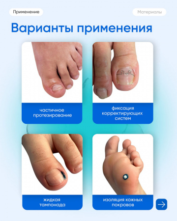 ПодолДжест ТЕМПО,синий 7 гр М